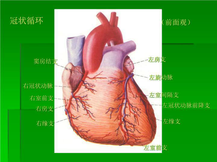 最新心肌缺血与心肌梗死课件.ppt_第3页