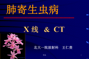 新版肺寄生虫病-X线&CT课件.ppt