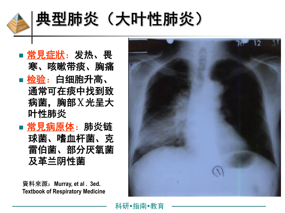 最新非典型病原体肺炎诊治进展课件.ppt_第2页