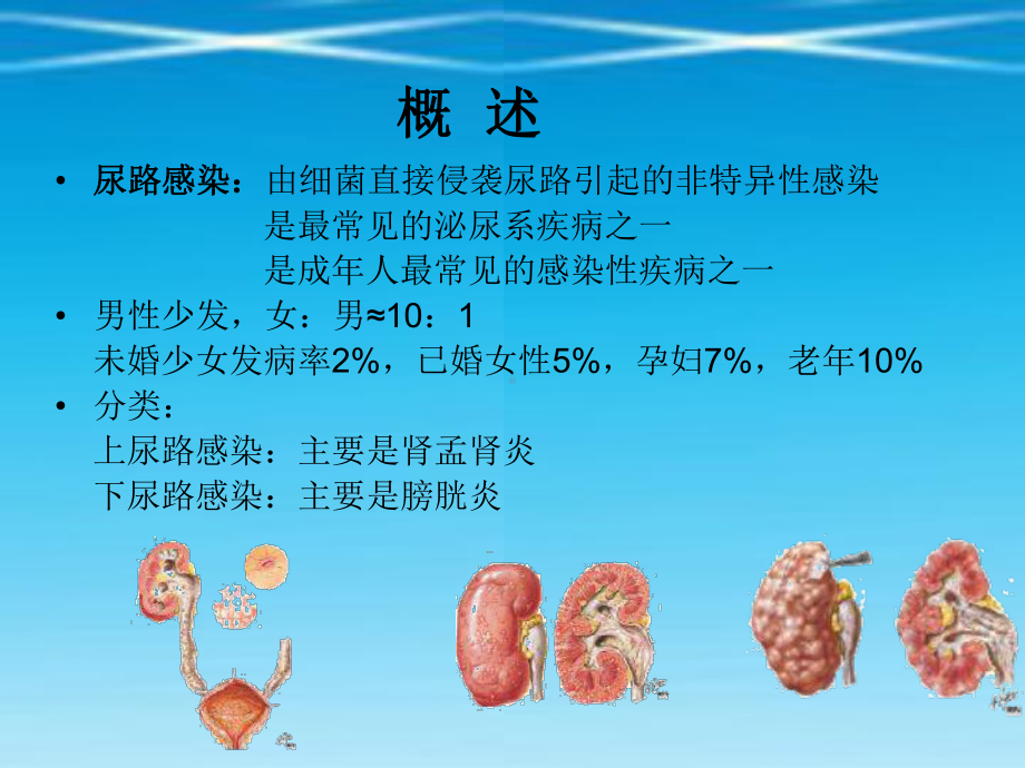 尿路感染-课件22.ppt_第2页