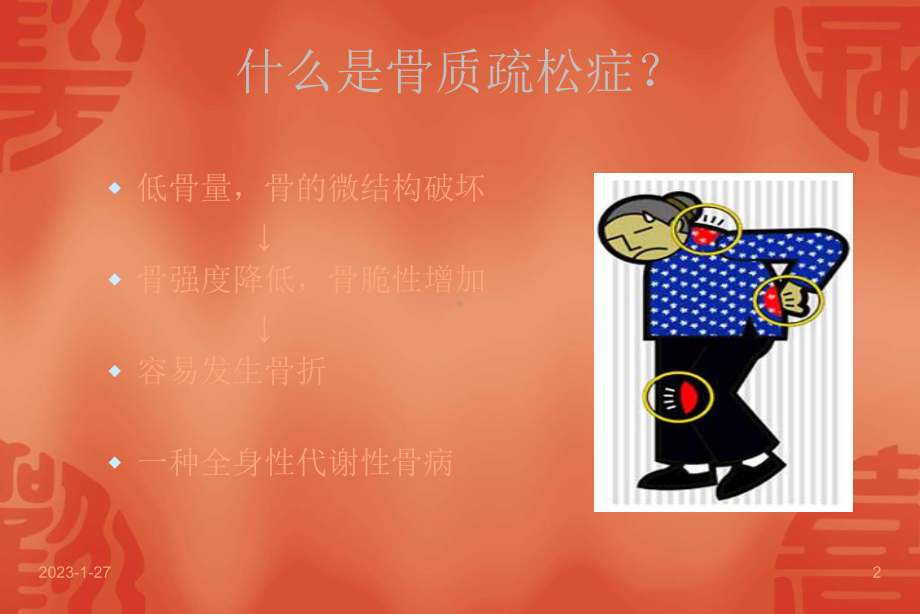 骨质疏松症诊治新进展-课件.ppt_第2页