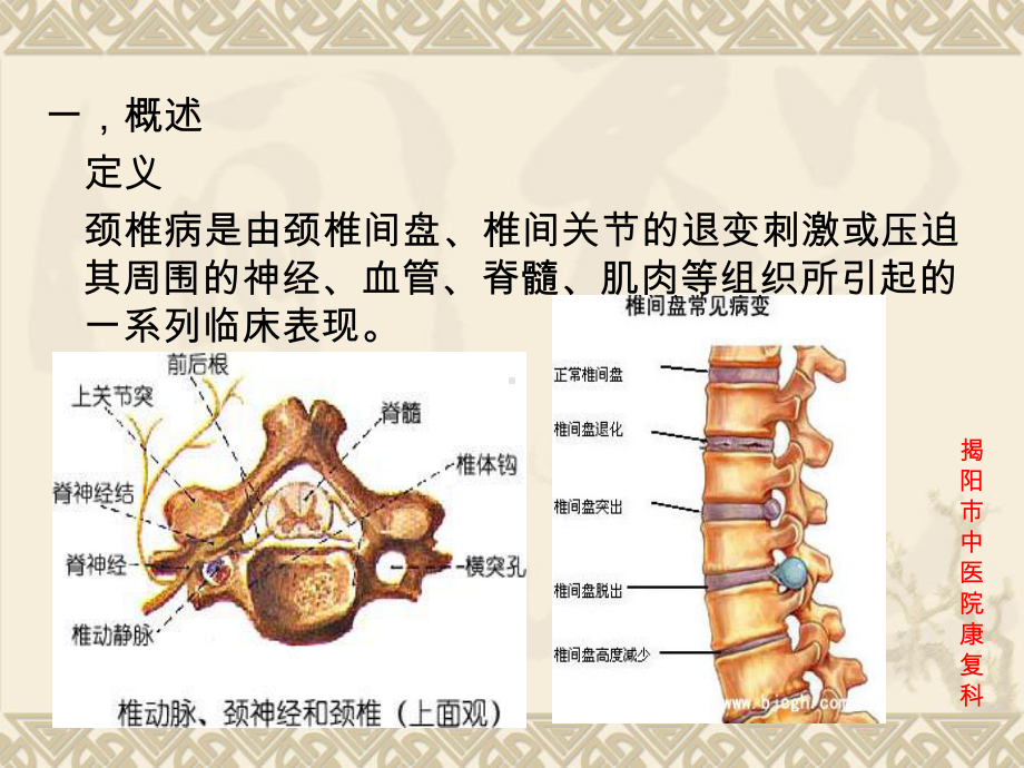 颈椎病防治教学文案课件.ppt_第2页