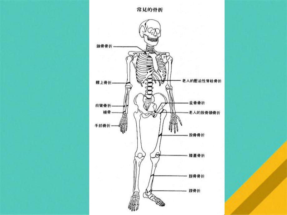 骨与关节损伤病人的护理课件.pptx_第2页