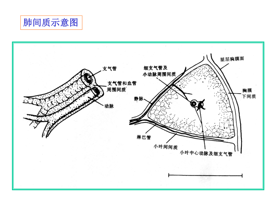 肺间质性病变-课件.ppt_第2页