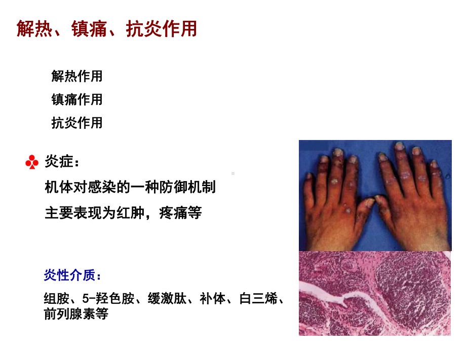 第十三章-非甾体抗炎药物主要内容课件.ppt_第3页