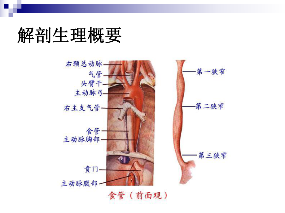 食管癌的治疗课件.ppt_第3页