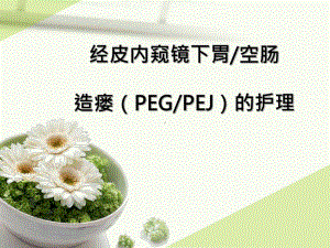 经皮内窥镜下胃空肠造瘘PEG、PEJ的护理（可编辑的）课件.ppt