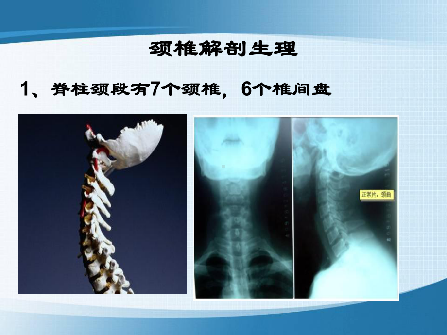 肿瘤外科学-颈椎病课件.ppt_第3页