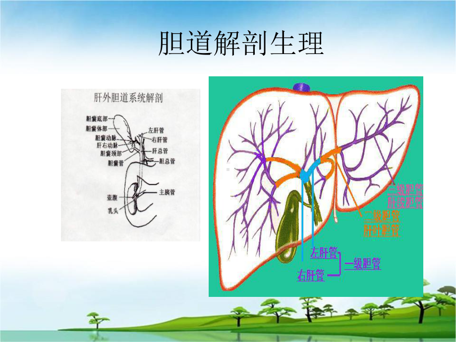 胆囊结石及其防治-课件.ppt_第2页