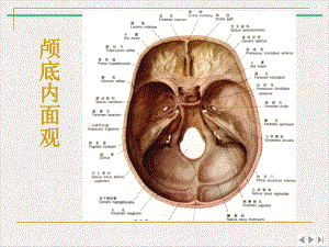 颅底结构的影像解剖及病变分析肖慧新版课件.pptx