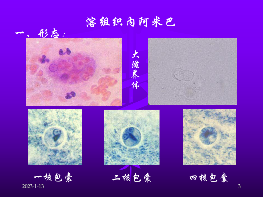 第三十四章医学原虫课件.ppt_第3页