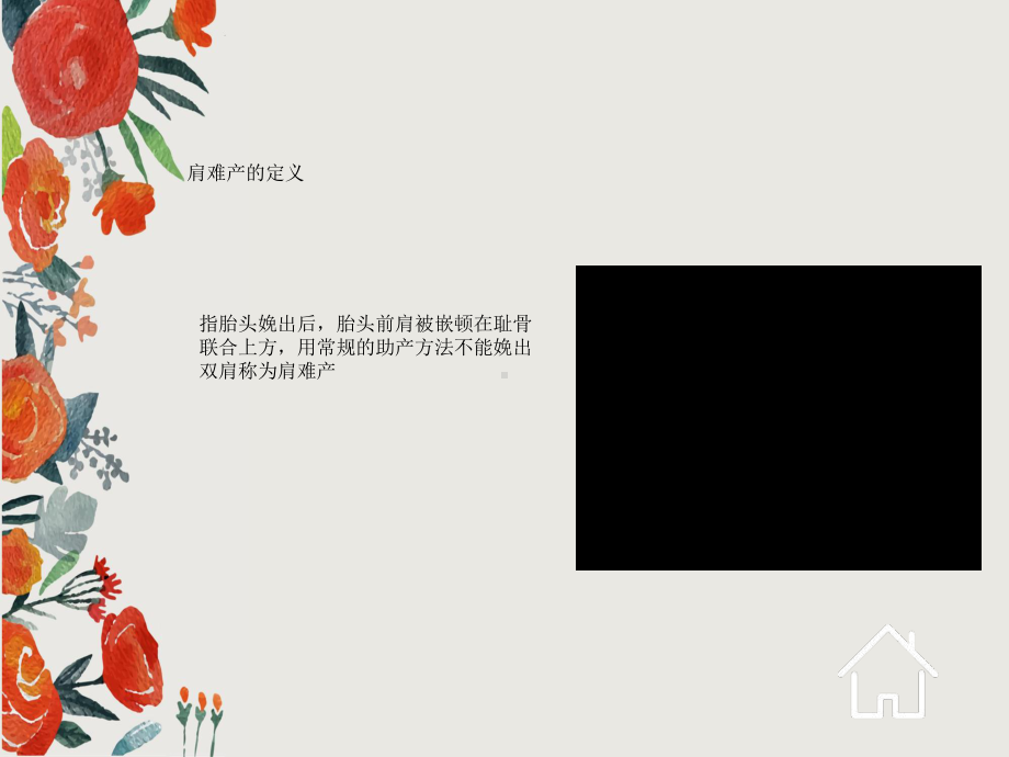 肩难产案例分析课件.ppt_第2页