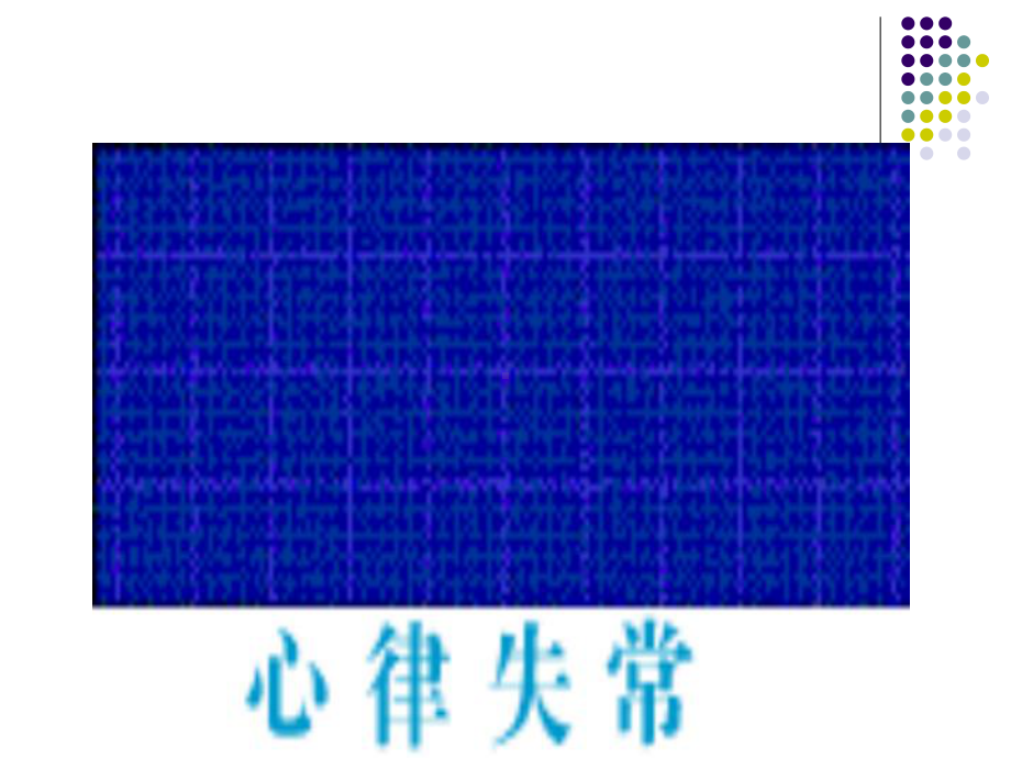 第22章抗心律失常药-药理学课件.ppt_第2页