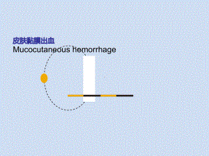 皮肤黏膜出血-课件.ppt