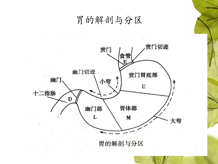 胃大部切除手术配合课件.ppt_第3页