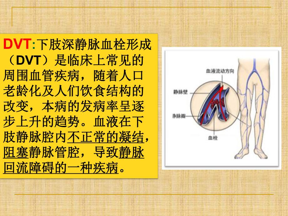 预防下肢深静脉血栓的护理-课件.ppt_第3页