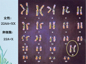 第三节-伴性遗传课件.pptx