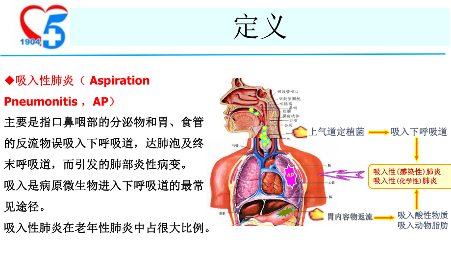 老年吸入性肺炎的诊治与预防课件.pptx_第3页