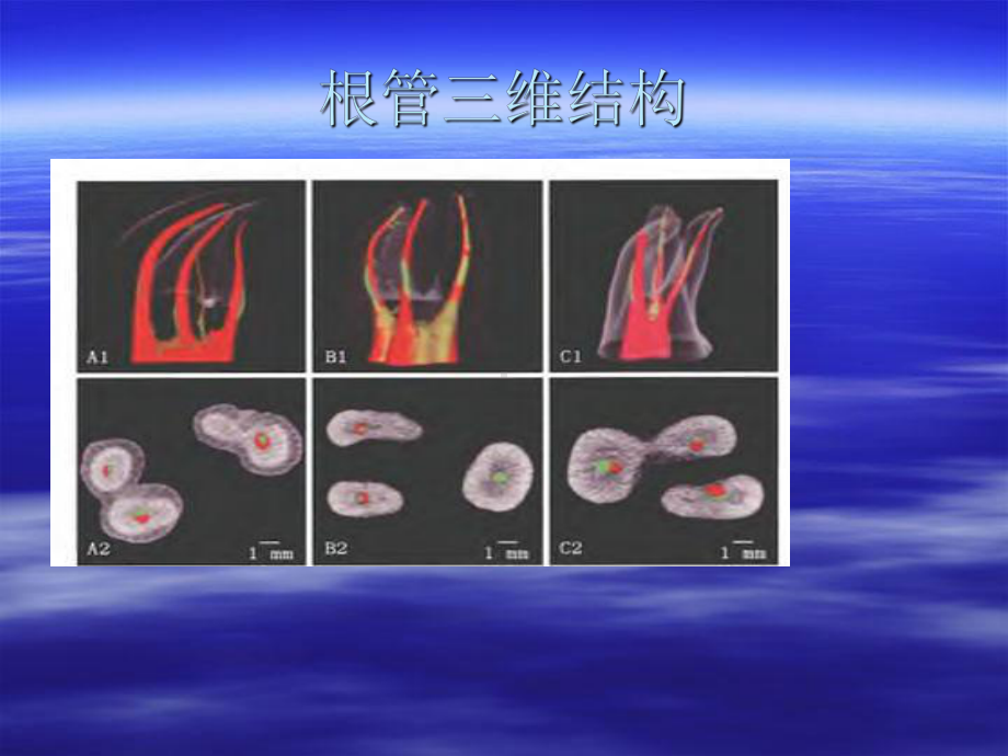 根管冲洗与消毒课件.ppt_第2页