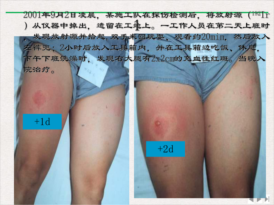 辐射防护工作知识和卫生监督优质课件.ppt_第3页