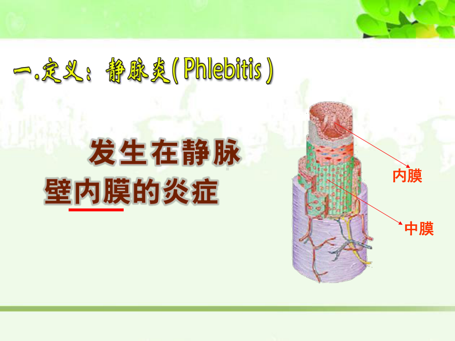 静脉炎的预防和护理课件.ppt_第3页