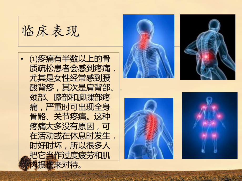 骨质疏松健康教育讲座-资料课件.ppt_第3页