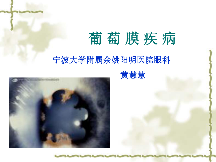 本葡萄膜病a-课件.ppt_第1页