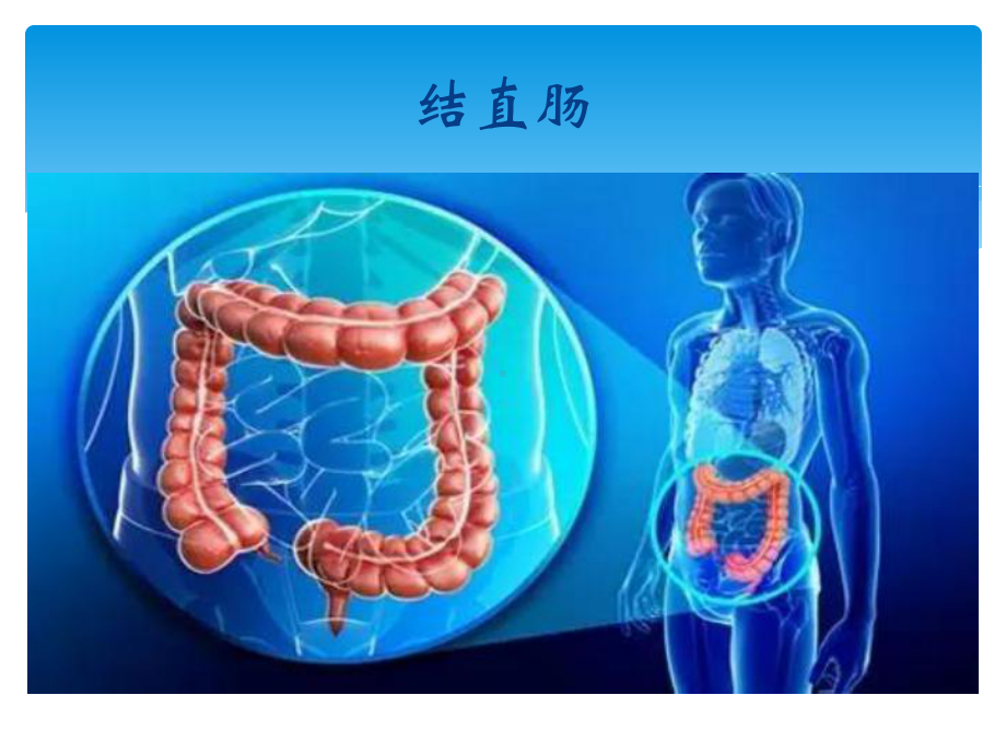 结直肠癌的folfox化疗方案.pptx_第2页