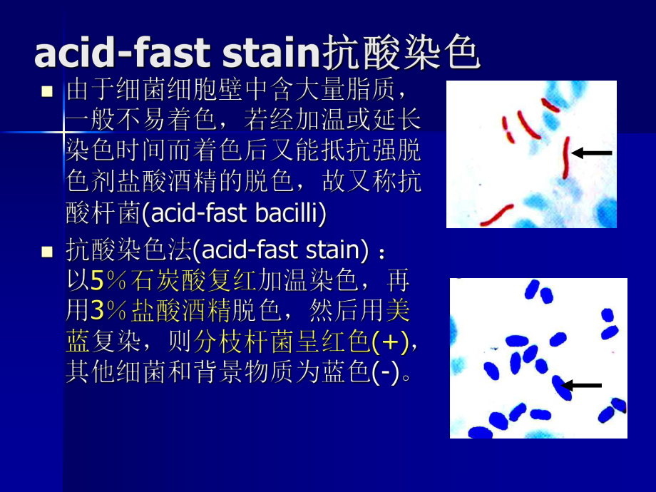 第14章-分枝杆菌属课件.ppt_第3页