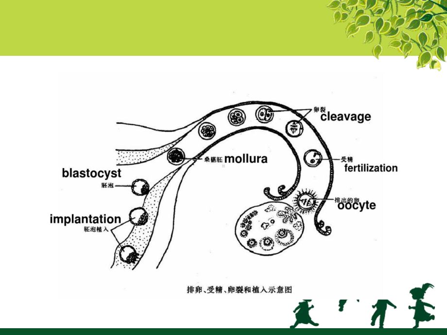 宫外孕教学课件.ppt_第1页