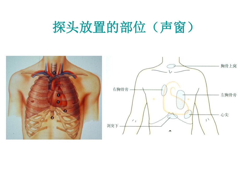 超声心动图入门课件.ppt_第3页