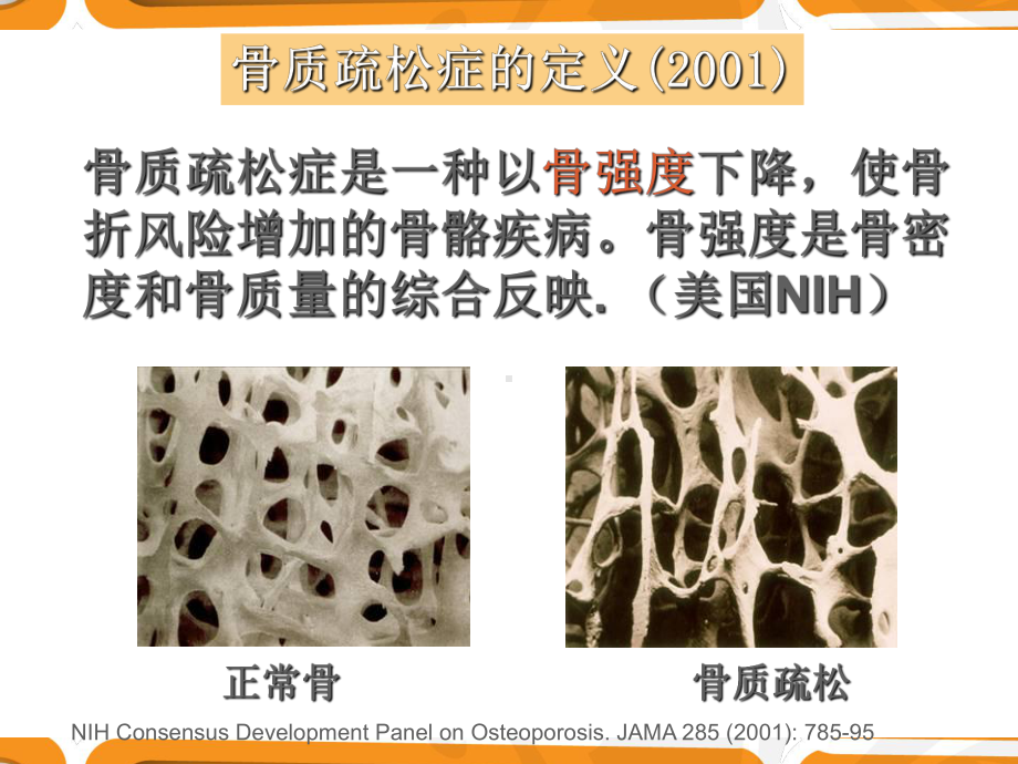 骨质疏松药物治疗讲座课件.ppt_第3页