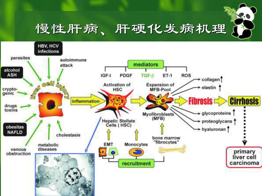 肝癌影像诊断讲解课件.ppt_第3页