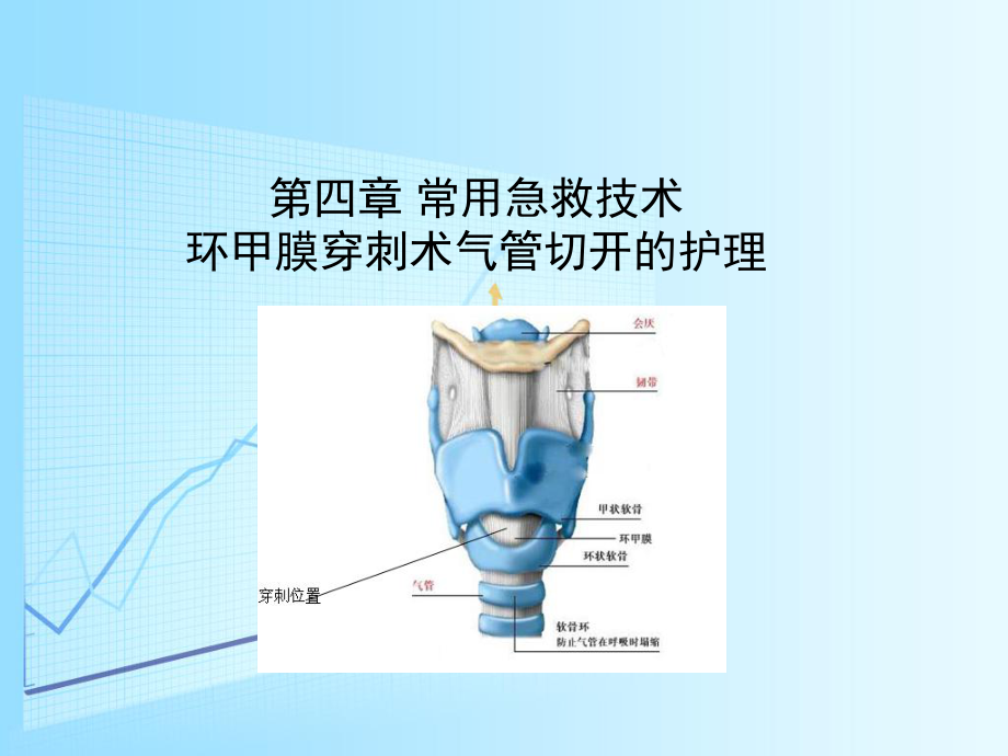 第四章常用急救技术-第节-环甲膜穿刺术切开术课件.ppt_第1页