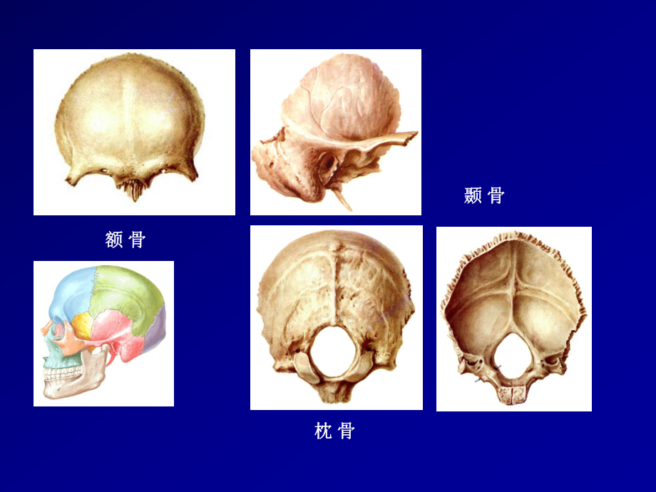 颅骨及其连接1课件.ppt_第3页