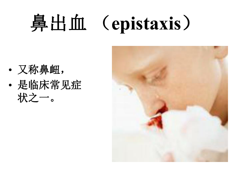 鼻出血部位的评估课件.ppt_第2页