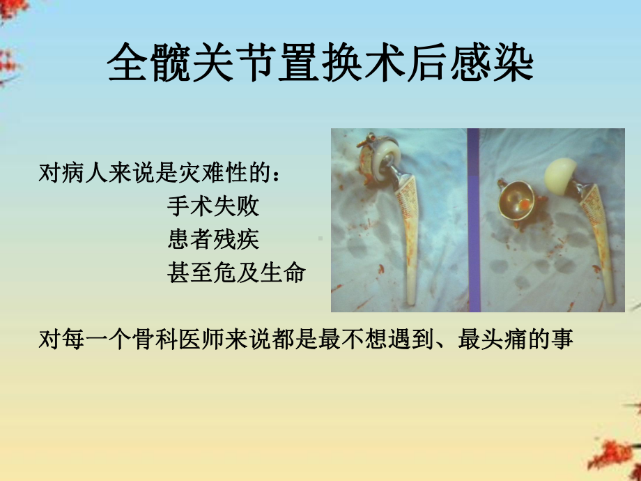 髋关节置换术后感染的诊断和治疗课件.ppt_第2页