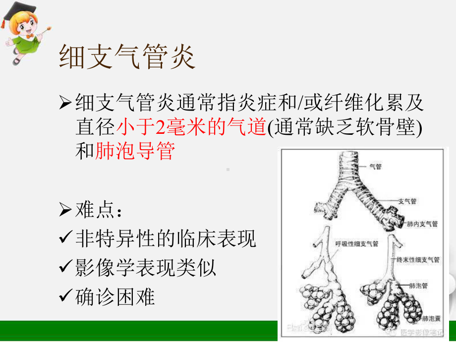 细支气管炎课件.pptx_第3页