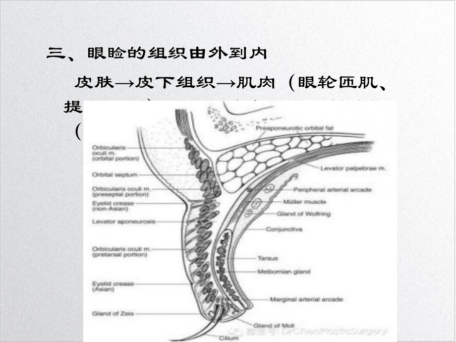 重睑术双眼皮课件实用版.ppt_第3页