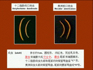 钩虫蛲虫丝虫教学课件.pptx