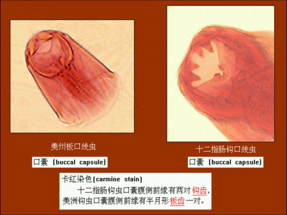 钩虫蛲虫丝虫教学课件.pptx_第2页