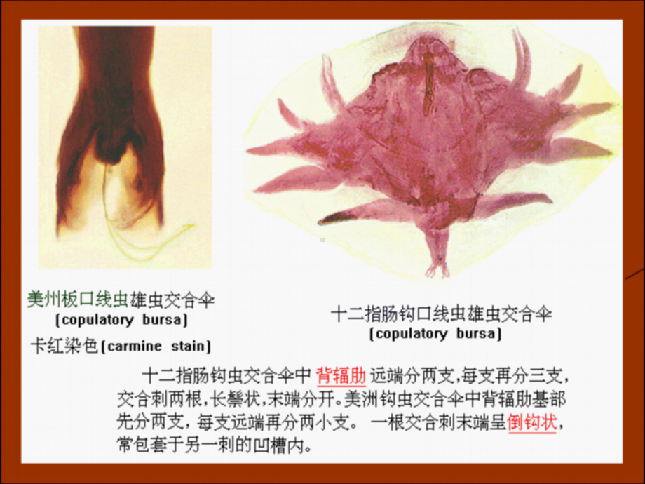 钩虫蛲虫丝虫教学课件.pptx_第3页