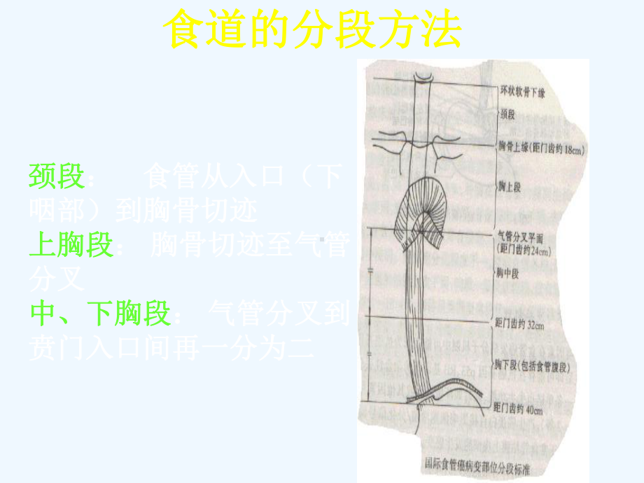 食管癌放射治疗靶区勾画-cui课件.ppt_第3页