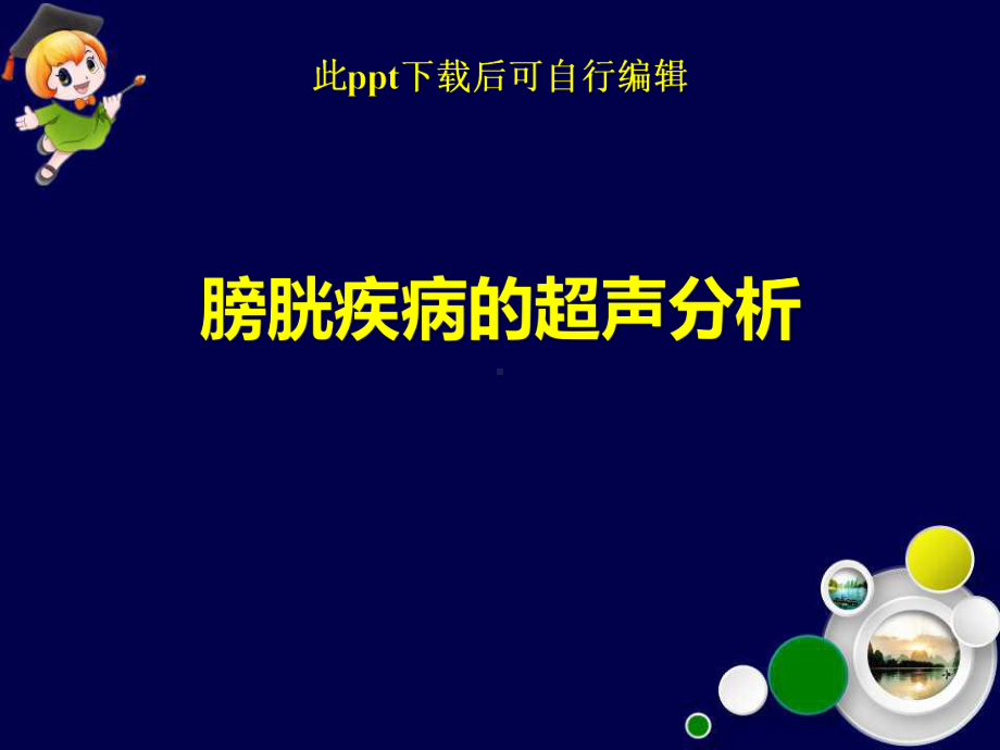 膀胱疾病的超声分析课件.ppt_第1页