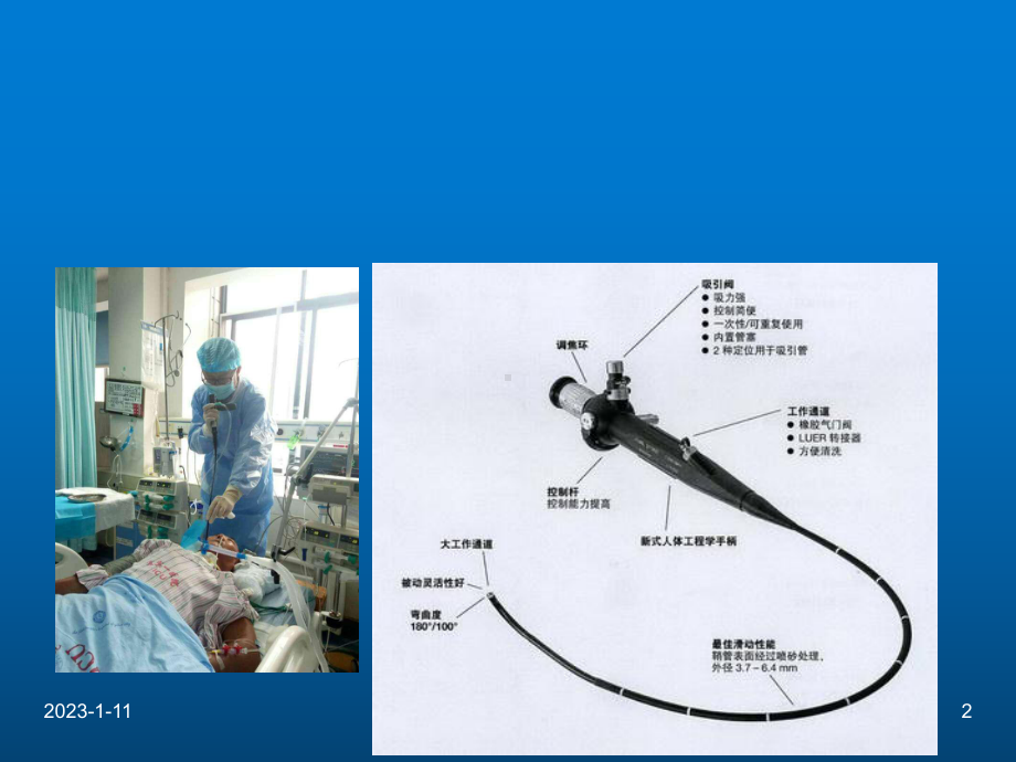 纤维支气管镜的临床应用医学课件-.ppt_第2页