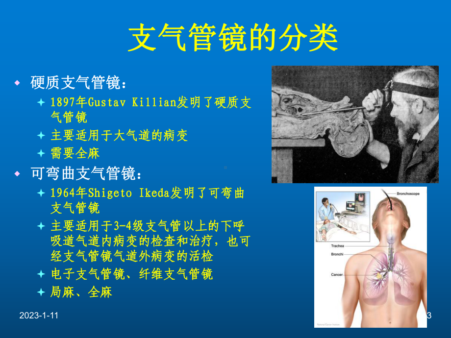 纤维支气管镜的临床应用医学课件-.ppt_第3页