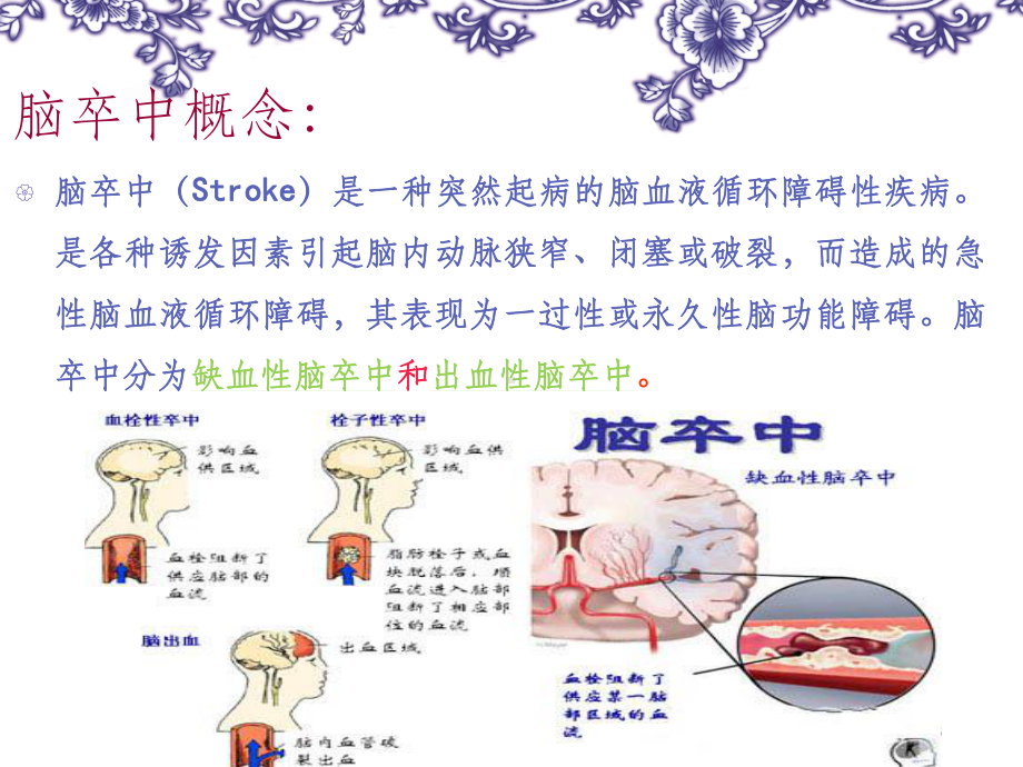 脑卒中护理新进展课件.ppt_第3页