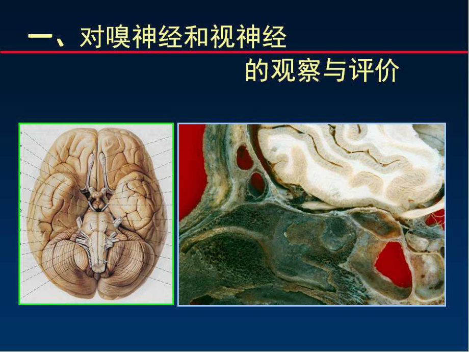 颅神经及其病变影像谢鹏课件.ppt_第2页