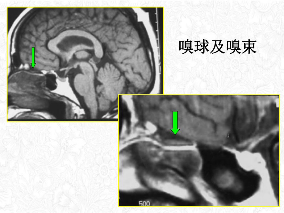 颅神经及其病变影像谢鹏课件.ppt_第3页