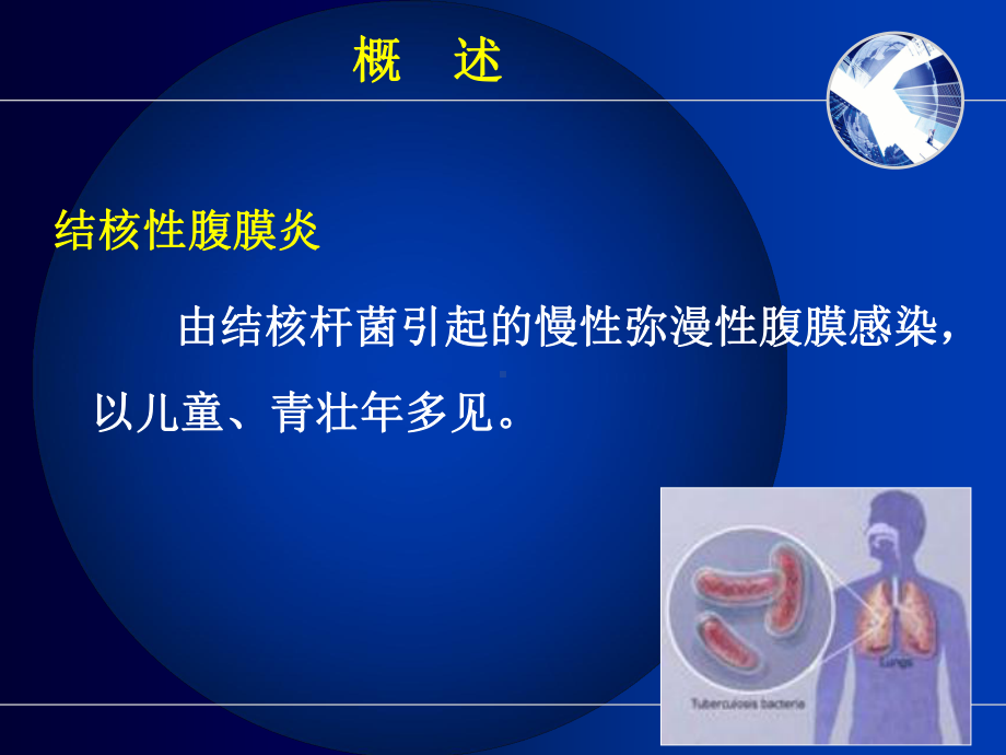 结核性腹膜炎病人护理课件.ppt_第2页